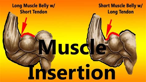 bad muscle insertions|different muscle insertions.